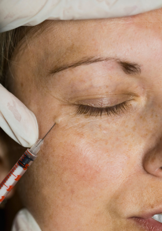 Anti-Wrinkle Treatments