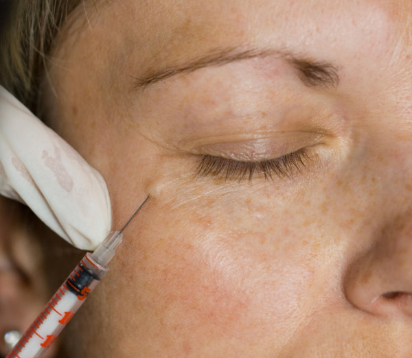 Anti-Wrinkle Treatments