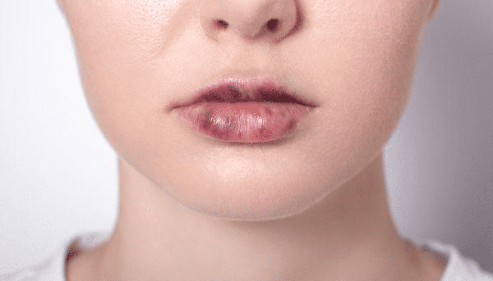 aesthetic complications