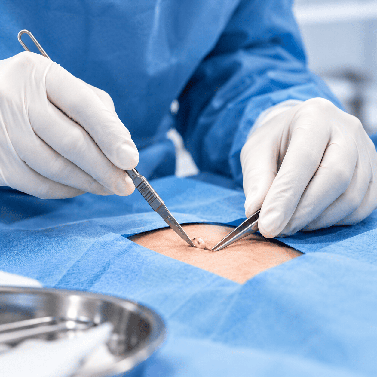 minor surgery